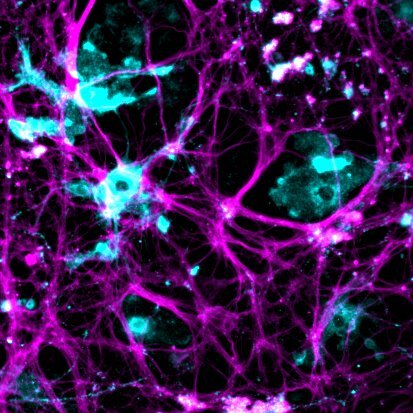 neuronmicroglia.jpg