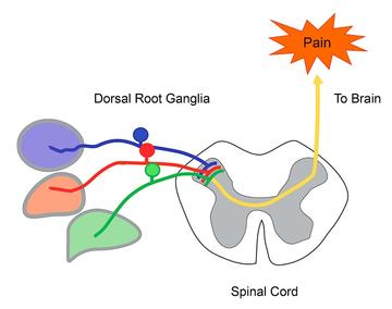 pain_diagram.jpg